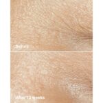 Clinique Smart Clinical Repair™ Wrinkle Correcting Cream 50ml