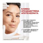 L’Oreal Paris Revitalift Laser Renew SPF20 Αντιγηραντική Κρέμα 50ml