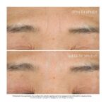 Dior Capture Totale Hyalushot Wrinkle Corrector 15ml