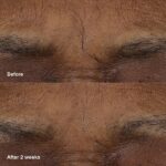 Clinique Smart Clinical Repair™ AM/PM Retinoid Balm 3g