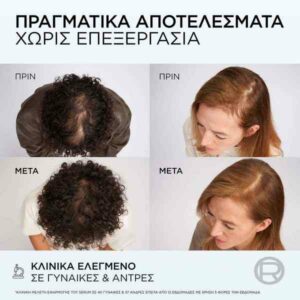 L’Oreal Elvive Growth Booster Serum Κατά Της Τριχόπτωσης 102ml