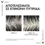 Vichy Dercos Anti-Dandruff DS Refill Σαμπουάν Κατά Ξηροδερμίας, Πιτυρίδας & Κνησμού Για Ξηρά Μαλλιά Ανταλλακτικό 390ml